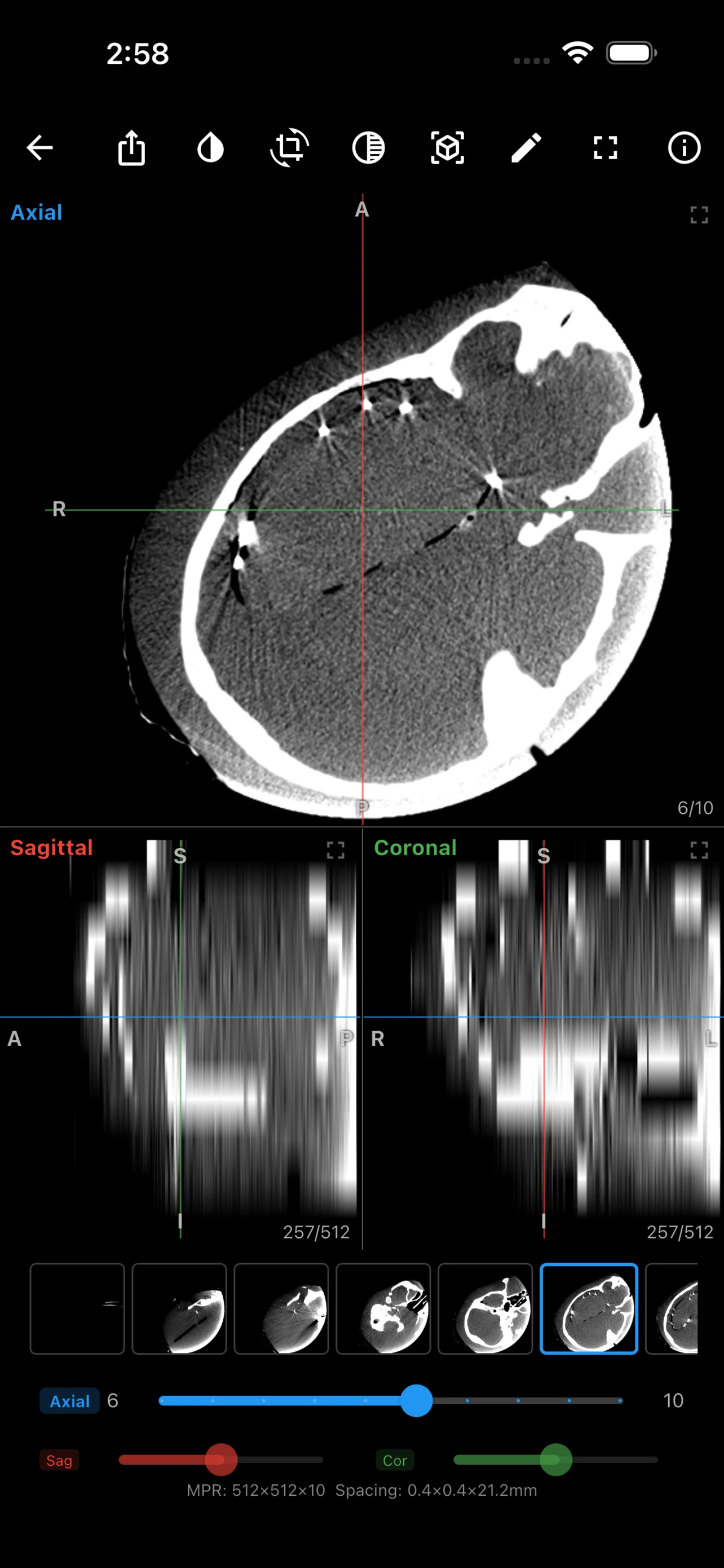 MedView screenshot