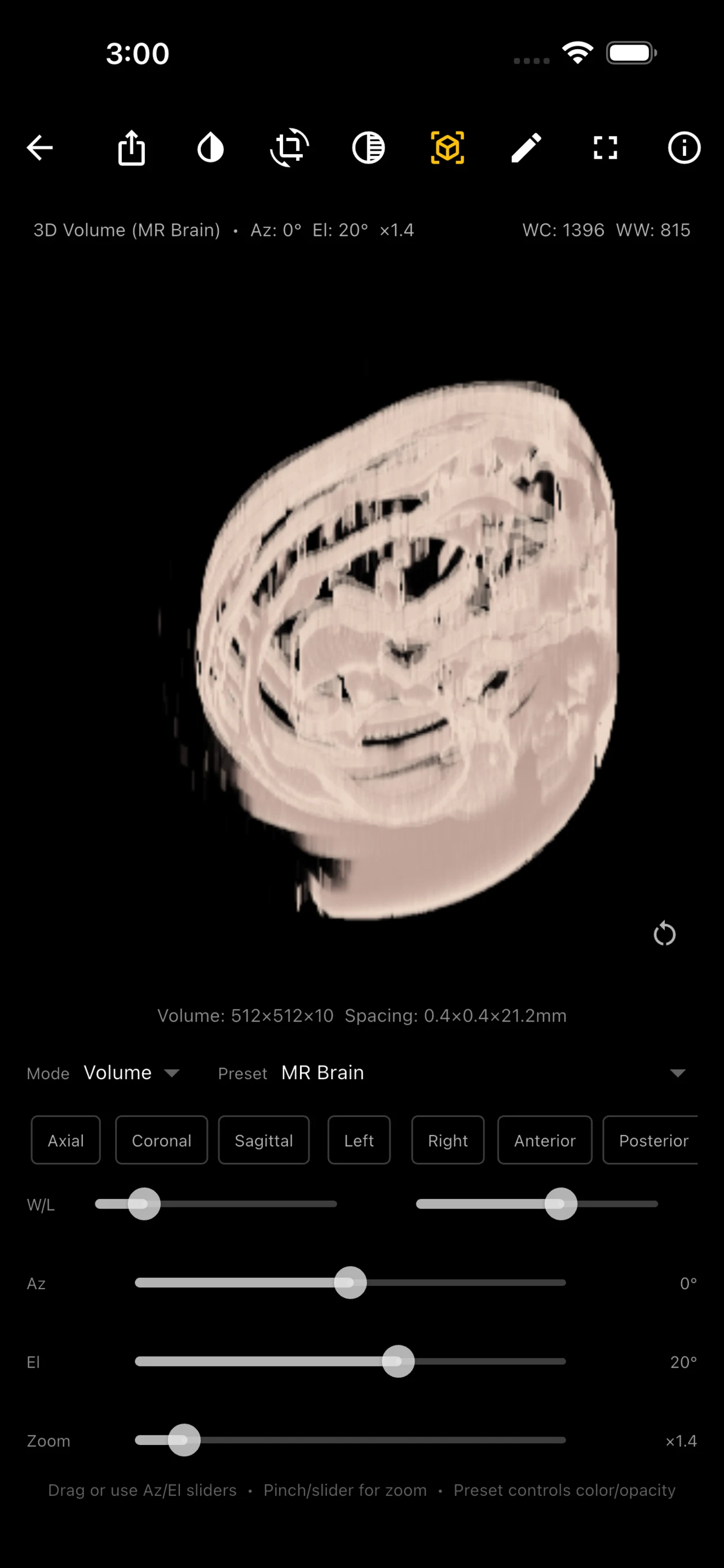 MedView screenshot