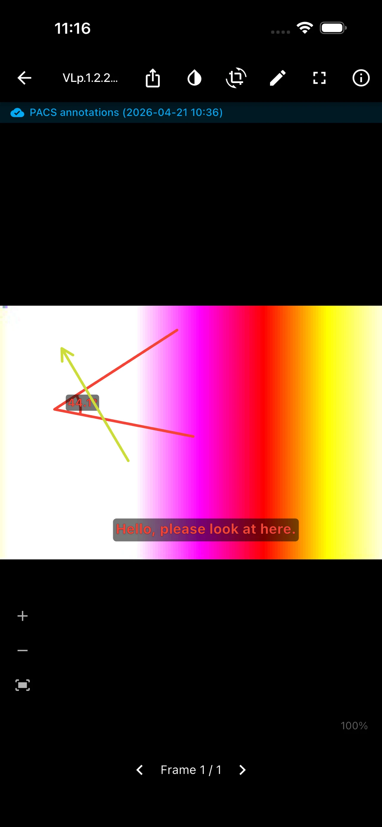 MedView screenshot